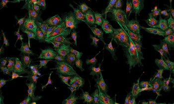 Image: Whole slide fluorescence scanning on the Leica SCN400 F (Photo courtesy of Leica Microsystems). 